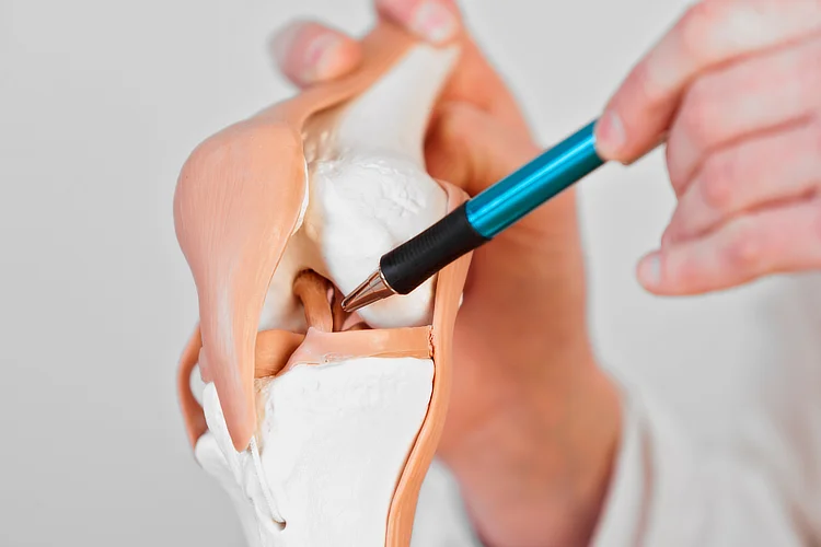 Knee anatomy model showing ACL structure during a consultation in Singapore.