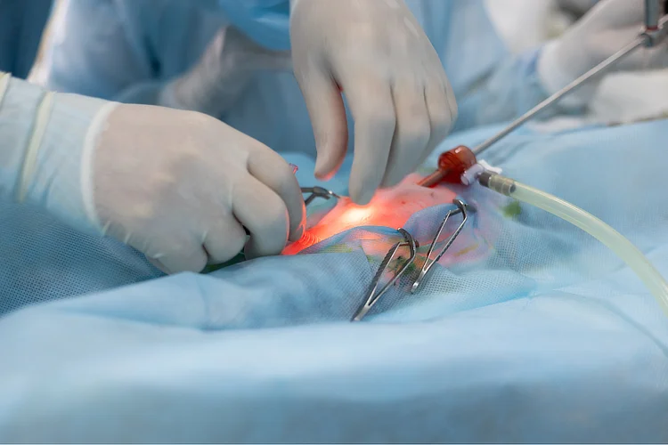 Arthroscopic meniscus surgery using small incisions for faster recovery and fewer complications.