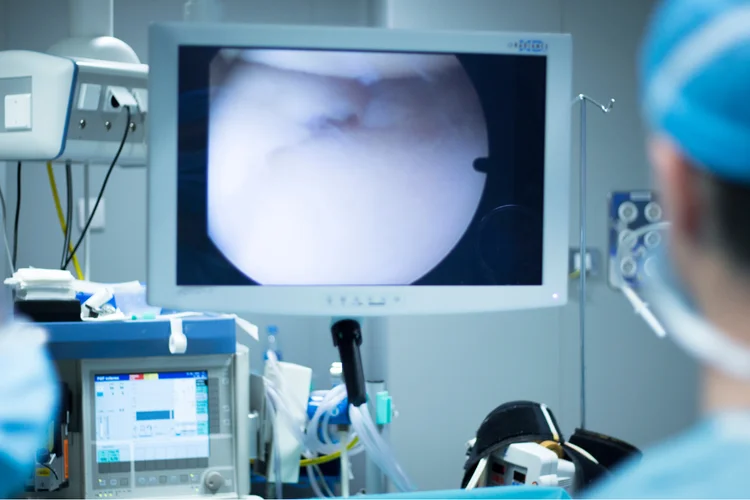 Monitor showing real-time knee joint arthroscopy.
