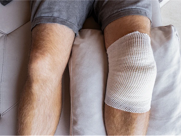 Bandaged knee after meniscus surgery showing early recovery and post-op care.