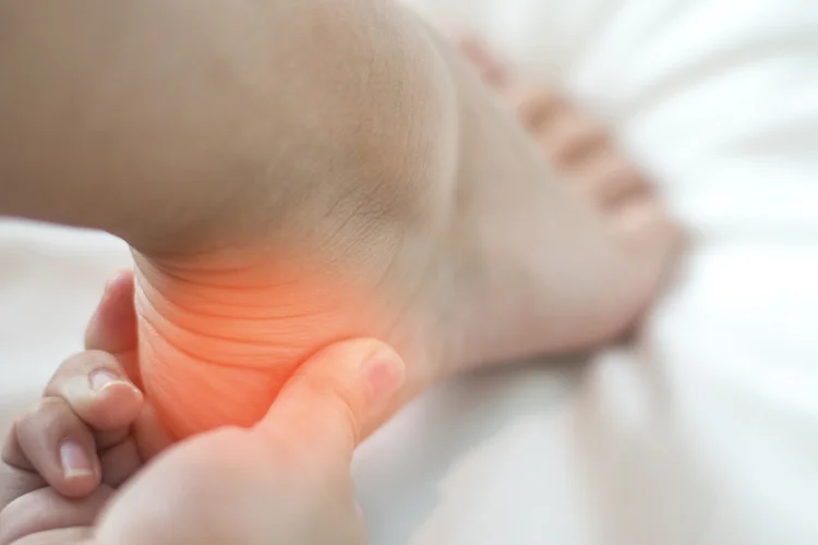 Close-up of person pressing inflamed heel with visible pain as a symptom of heel sports injury.