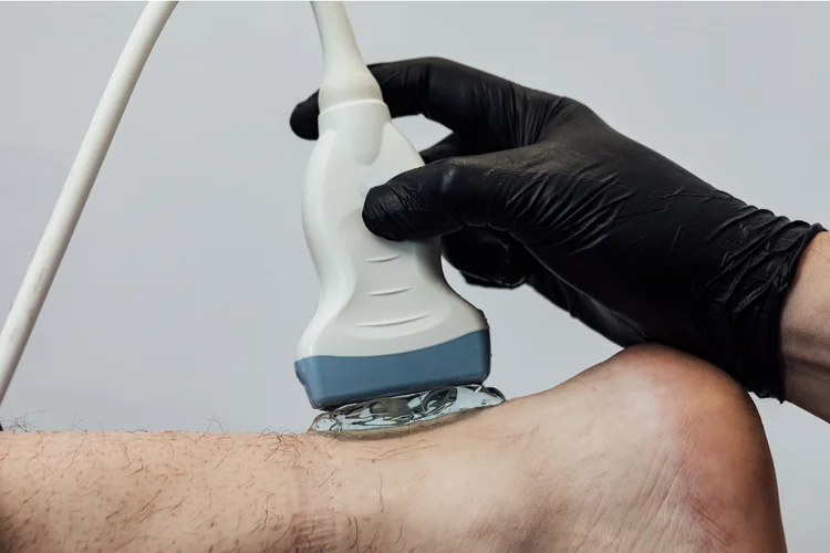 Doctor using ultrasound to assess ankle injury.