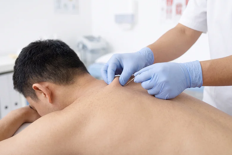 Physiotherapist performing trigger point dry needling on a patient's shoulder.