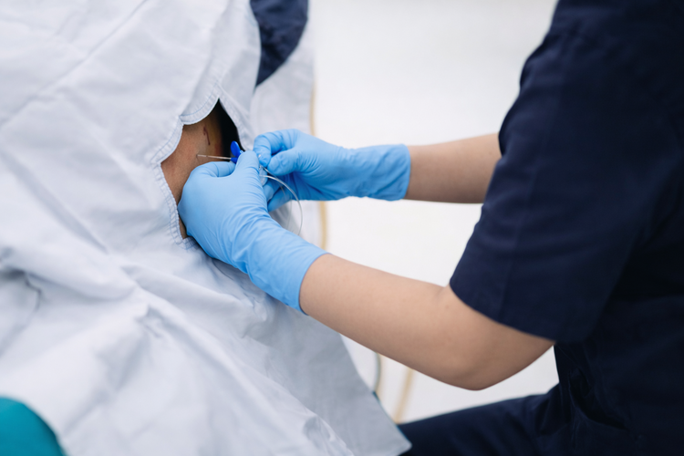 Specialist inserting needle into lower back during epidural steroid injection.