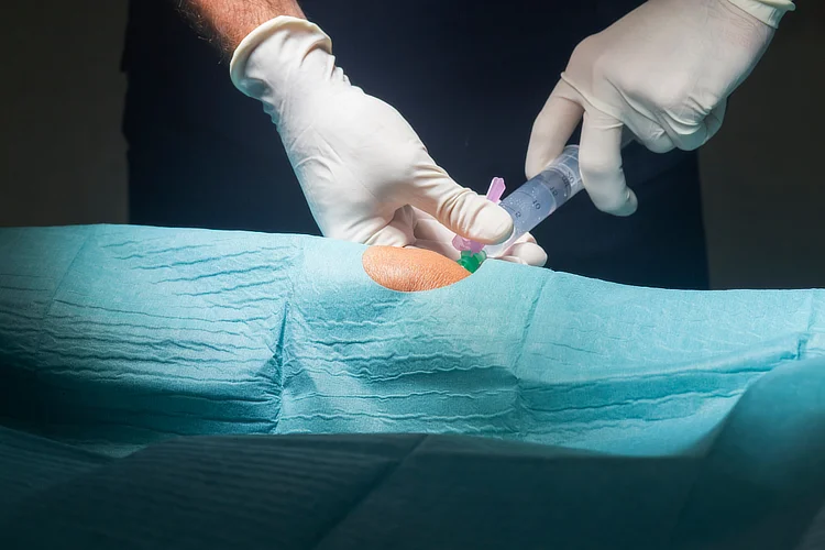 Knee injection administered before meniscus surgery for anaesthesia and pain control.