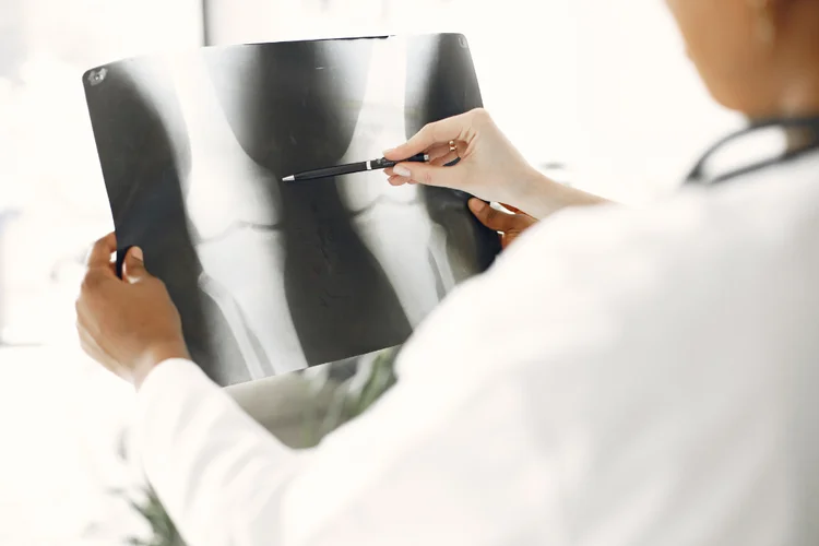 Specialist reviewing knee X-ray for bone condition.