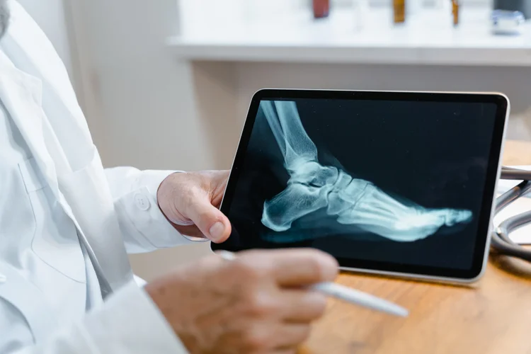 Orthopaedic doctor reviewing foot X-ray on tablet to assess structural cause of ongoing foot pain.