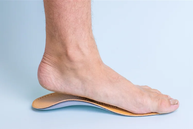 Custom orthotic insole used to support arch and reduce plantar fascia strain.