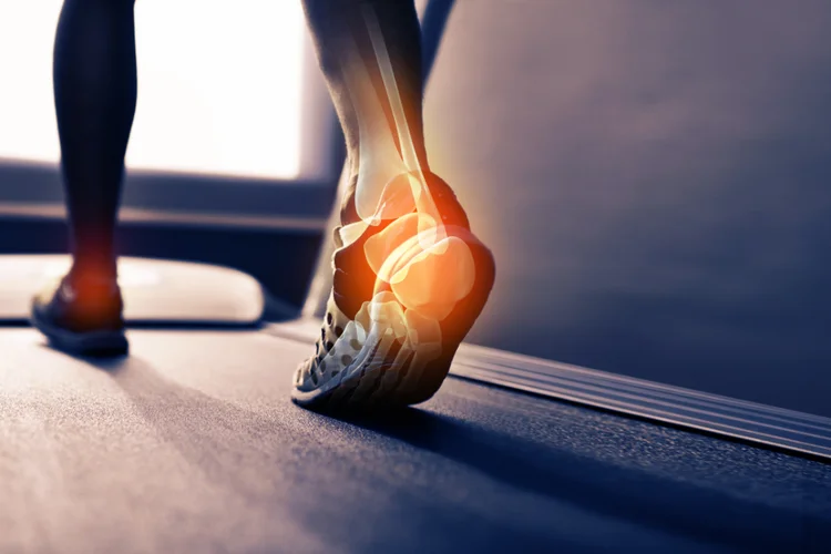 Runner’s heel highlighted with stress and strain showing risk factors for heel sports injuries.