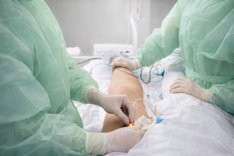 Surgical team performing thermal radiofrequency ablation procedure on patient.