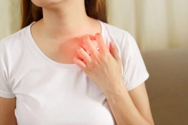Woman touching collarbone with visible redness from pain or inflammation.