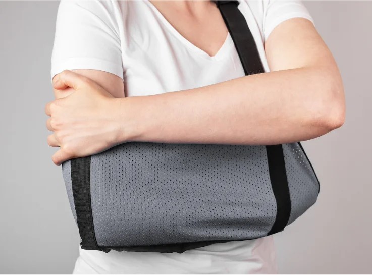 Woman using shoulder sling after dislocation to support healing and prevent reinjury.